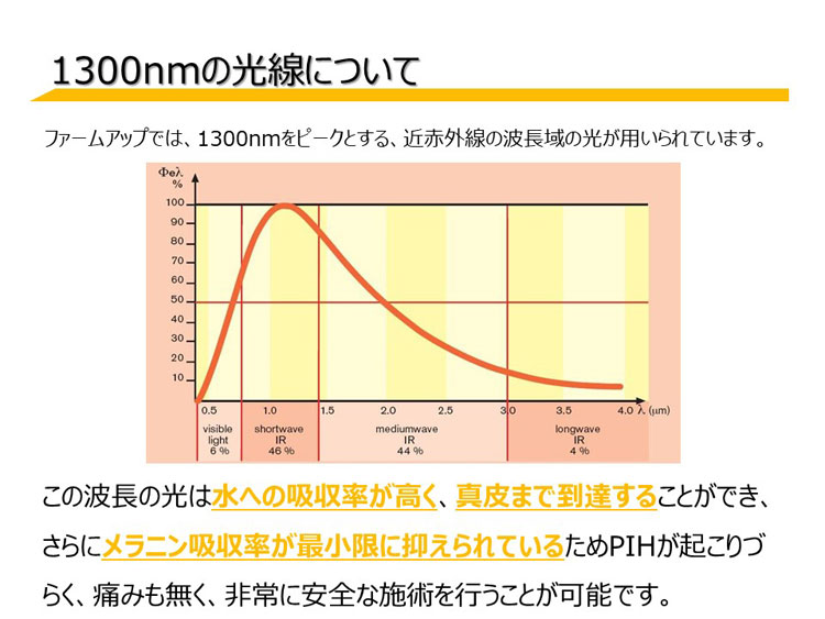 ファームアップについてイメージ