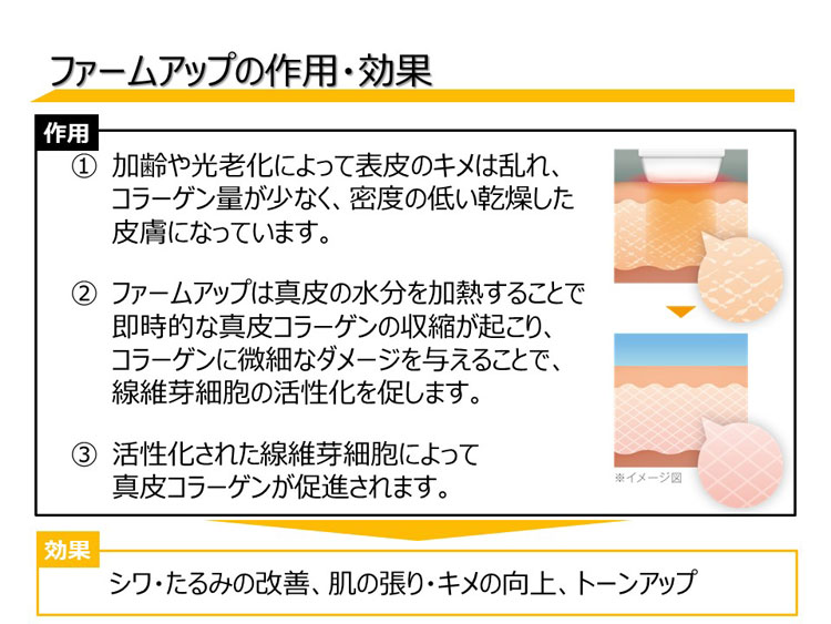 ファームアップについてイメージ