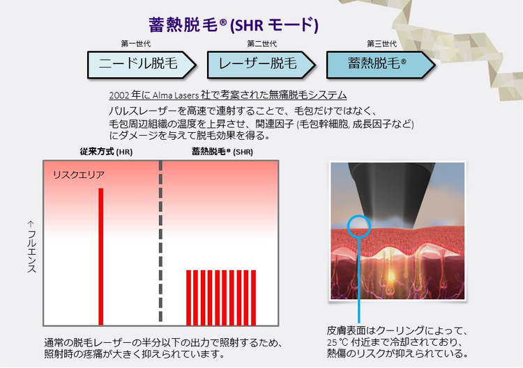 医療レーザー脱毛（保険適応外・自由診療）についてイメージ