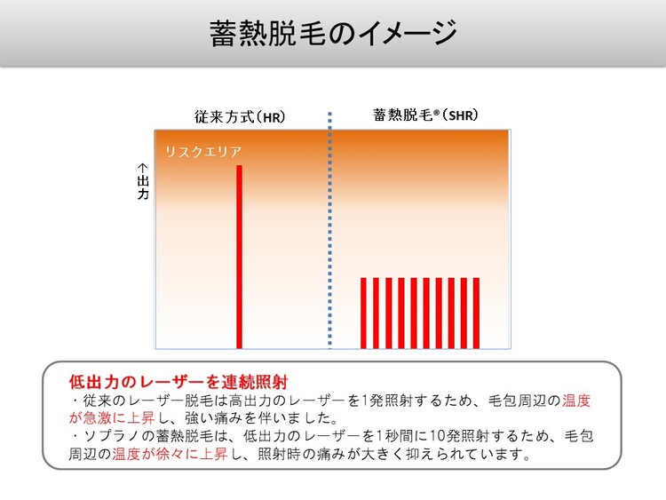 医療レーザー脱毛（保険適応外・自由診療）についてイメージ